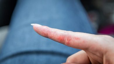 Cep Telefonları Alerjik Hastalıklara Yol Açar mı?